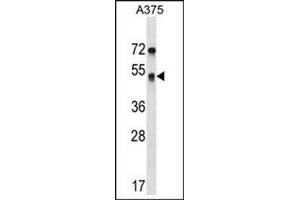Western blot analysis of SEPT11 Antibody (Center) Cat. (Septin 11 抗体  (Middle Region))