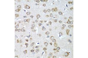 Immunohistochemistry of paraffin-embedded mouse brain using EIF1AX antibody (ABIN5973507) at dilution of 1/100 (40x lens). (EIF1AX 抗体)