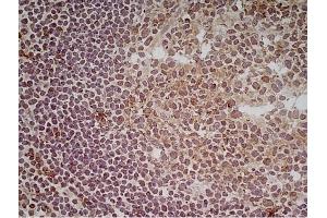 Immunoperoxidase staining of a human tonsil cryosection with Mouse anti Human CD70 antibody, clone Bu69 followed by the Histar setection system. (CD70 抗体)