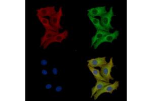 ABIN7093775 and ABIN7097816 staining HepG2 cells by IF/ICC. (Interleukin 17a 抗体  (Internal Region))