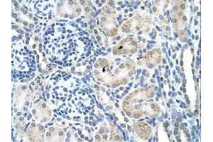 SPPL2B antibody was used for immunohistochemistry at a concentration of 4-8 ug/ml. (SPPL2B 抗体  (N-Term))