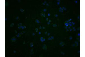 Immunofluorescence staining of PC3 cells with ABIN7163924 at 1:200, counter-stained with DAPI. (KCNK15 抗体  (AA 244-330))