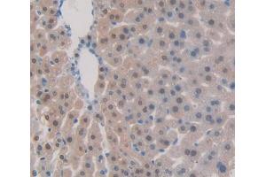 Used in DAB staining on fromalin fixed paraffin- embedded Kidney tissue (TNFSF9 抗体  (AA 105-309))
