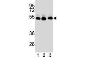 TUBB2B antibody western blot analysis of (1) HepG2, (2) HeLa, (3) MDA-MB231 lysate (TUBB2B 抗体  (AA 12-39))