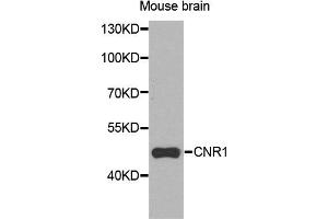 Western blot analysis of extracts of mouse brain cells, using CNR1 antibody. (CNR1 抗体)