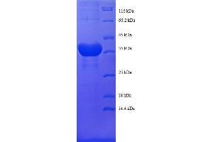 Histone H2B Type 1-C/E/F/G/I (LOC100407767) (AA 2-125), (full length) protein (GST tag) (Histone H2B Type 1-C/E/F/G/I (LOC100407767) (AA 2-125), (full length) protein (GST tag))