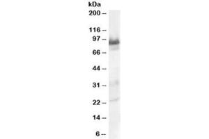 Western blot testing of human heart lysate with TRAK1 antibody at 0. (TRAK1 抗体)