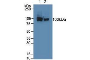 Rabbit Capture antibody from the kit in WB with Positive Control: Human hela cells.