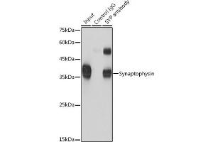 Immunoprecipitation analysis of 600 μg extracts of Mouse brain cells using 3 μg Synaptophysin antibody (ABIN6135349, ABIN6148783, ABIN6148784 and ABIN6221958). (Synaptophysin 抗体  (AA 150-250))