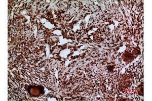 Immunohistochemistry (IHC) analysis of paraffin-embedded Human Lung, antibody was diluted at 1:100. (LAMC2 抗体  (C-Term))