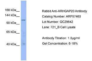 WB Suggested Anti-ARHGAP20  Antibody Titration: 0. (ARHGAP20 抗体  (Middle Region))