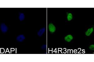Immunofluorescence analysis of 293T cells using Symmetric DiMethyl-Histone H4-R3 antibody (ABIN3017488, ABIN3017489, ABIN3017490, ABIN1680265 and ABIN6220116). (Histone H4 抗体  (2meArg3))