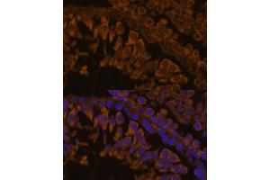 Immunofluorescence analysis of rat testis using ZPBP antibody (ABIN7271569) at dilution of 1:100. (ZPBP 抗体  (AA 45-200))