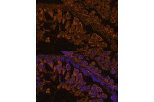 Immunofluorescence analysis of rat testis using ZPBP antibody (ABIN7271569) at dilution of 1:100. (ZPBP 抗体  (AA 45-200))