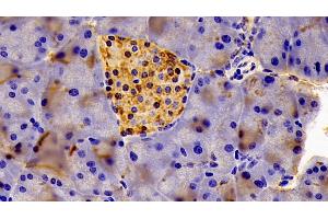 Detection of EIF2aK3 in Mouse Pancreas Tissue using Polyclonal Antibody to Eukaryotic Translation Initiation Factor 2 Alpha Kinase 3 (EIF2aK3)