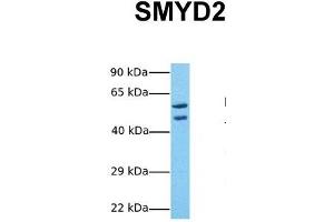 Host:  Rabbit  Target Name:  SMYD2  Sample Tissue:  Human 293T  Antibody Dilution:  1. (SMYD2A 抗体  (Middle Region))
