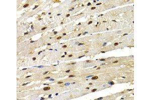 Immunohistochemistry of paraffin-embedded Rat heart using IRF2 Polyclonal Antibody at dilution of 1:200 (40x lens). (IRF2 抗体)