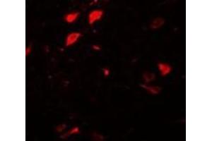 Immunofluorescence of DLCK3 in human brain tissue with AP30278PU-N DLCK3 antibody at 20 μg/ml. (DCLK3 抗体  (N-Term))