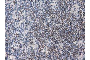 Image no. 6 for anti-Ankyrin Repeat Domain 53 (ANKRD53) (AA 1-300) antibody (ABIN1490720) (ANKRD53 抗体  (AA 1-300))