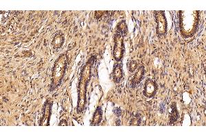 Immunohistochemistry (IHC) image for anti-Clusterin (CLU) (AA 229-446) antibody (ABIN7436996)
