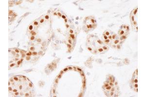 Immunohistochemistry (IHC) image for anti-Estrogen Receptor 1 (ESR1) (AA 1-50) antibody (ABIN7454639)