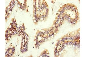 Immunohistochemistry (IHC) image for anti-Guanine Nucleotide Binding Protein (G Protein), beta Polypeptide 2 (GNB2) (AA 1-340) antibody (ABIN7154692)