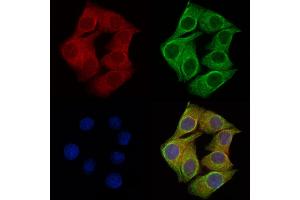 ABIN6257431 and ABIN6275975 staining Hela cells by IF/ICC. (PTH1R 抗体  (pThr1))