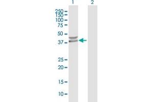 Western Blotting (WB) image for anti-Protein Phosphatase, Mg2+/Mn2+ Dependent, 1K (PPM1K) (AA 1-372) antibody (ABIN531049)