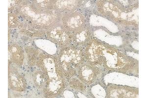 ABIN6256465 and ABIN6267170 at 1/100 staining human normal kidney tissue by IHC-P.