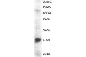 Image no. 1 for anti-PIN2/TERF1 Interacting, Telomerase Inhibitor 1 (PINX1) (AA 2-15) antibody (ABIN297473) (PINX1 抗体  (AA 2-15))