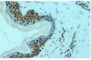 Image no. 3 for anti-Heterogeneous Nuclear Ribonucleoprotein L (HNRNPL) antibody (ABIN108588) (HNRNPL 抗体)