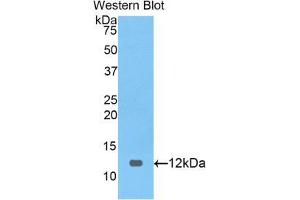 Western blot analysis of the recombinant protein. (PRAME 抗体  (AA 416-502))