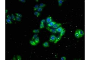 Immunofluorescence (IF) image for anti-Calcium Channel, Voltage-Dependent, alpha 2/delta Subunit 4 (CACNA2D4) (AA 934-1115) antibody (ABIN7175582)