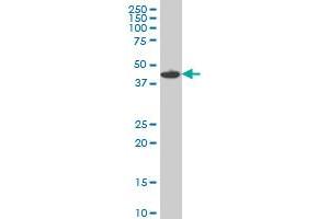 MKNK1 monoclonal antibody (M14), clone 2F12. (MKNK1 抗体  (AA 1-465))
