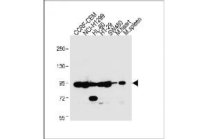 All lanes : Anti-NOD1 Antibody (C-term) at 1:2000 dilution Lane 1: CCRF-CEM whole cell lysate Lane 2: NCI- whole cell lysate Lane 3: HL-60 whole cell lysate Lane 4: HT-29 whole cell lysate Lane 5: S whole cell lysate Lane 6: Mouse heart lysate Lane 7: Mouse spleen lysate Lysates/proteins at 20 μg per lane. (NOD1 抗体  (C-Term))