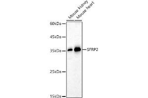 Western blot analysis of extracts of various cell lines, using SFRP2 antibody (ABIN6131355, ABIN6147675, ABIN6147677 and ABIN6221030) at 1:1000 dilution. (SFRP2 抗体  (AA 25-295))