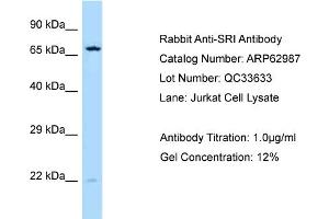 Western Blotting (WB) image for anti-Sorcin (SRI) (C-Term) antibody (ABIN2789324) (SRI 抗体  (C-Term))