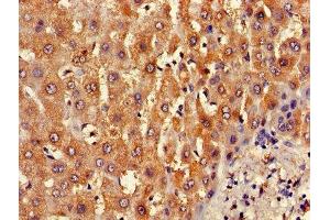 Immunohistochemistry of paraffin-embedded human liver tissue using ABIN7145367 at dilution of 1:100 (B3GALT2 抗体  (AA 201-422))