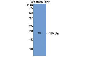 Western blot analysis of the recombinant protein. (ACVR2A 抗体  (AA 20-95))