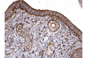 IHC-P Image T-Plastin antibody detects T-Plastin protein at cytoplasm on mouse cervix by immunohistochemical analysis. (Plastin 3 抗体)
