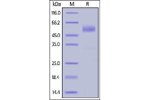 SDS-PAGE (SDS) image for Killer Cell Lectin-Like Receptor Subfamily K, Member 1 (KLRK1) (AA 73-216) (Active) protein (Fc Tag) (ABIN6938851)