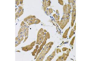 Immunohistochemistry of paraffin-embedded rat heart using MYO10 antibody (ABIN5974593) (40x lens). (Myosin X 抗体)