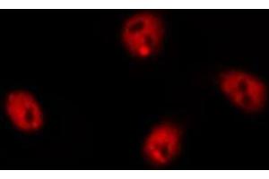 Immunofluorescence (fixed cells) (IF/ICC) image for anti-CTD (Carboxy-terminal Domain, RNA Polymerase II, Polypeptide A) Small Phosphatase 1 (CTDSP1) (N-Term) antibody (ABIN6258389)