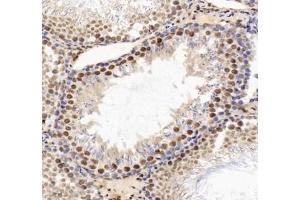 Immunohistochemistry analysis of paraffin-embedded rat testis using HNRNPM (ABIN7074247) at dilution of 1: 4000 (HnRNP M1-M4 抗体)
