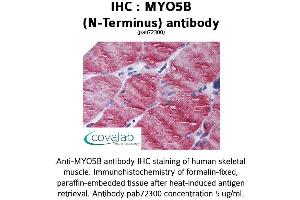 Image no. 1 for anti-Myosin VB (MYO5B) antibody (ABIN1737170) (MYO5B 抗体)