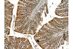 ABIN7094426 and ABIN7098473 at 1/100 staining Rat colorectal tissue by IHC-P. (COPB1 抗体  (Internal Region))