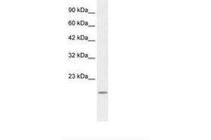 Image no. 2 for anti-BCL2-Associated X Protein (BAX) (N-Term) antibody (ABIN202051) (BAX 抗体  (N-Term))