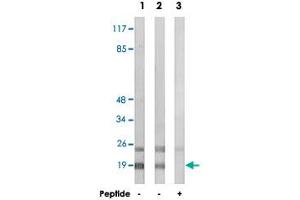 Western blot analysis of extracts from HepG2 cells (Lane 1 and lane 3) and HeLa cells (Lane 2), using RPL12 polyclonal antibody . (RPL12 抗体)