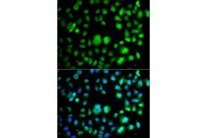 Immunofluorescence analysis of A549 cells using TET3 antibody.