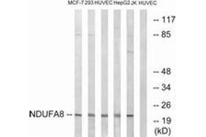 Western Blotting (WB) image for anti-NADH Dehydrogenase (Ubiquinone) 1 alpha Subcomplex, 8, 19kDa (NDUFA8) (AA 109-158) antibody (ABIN1535059)